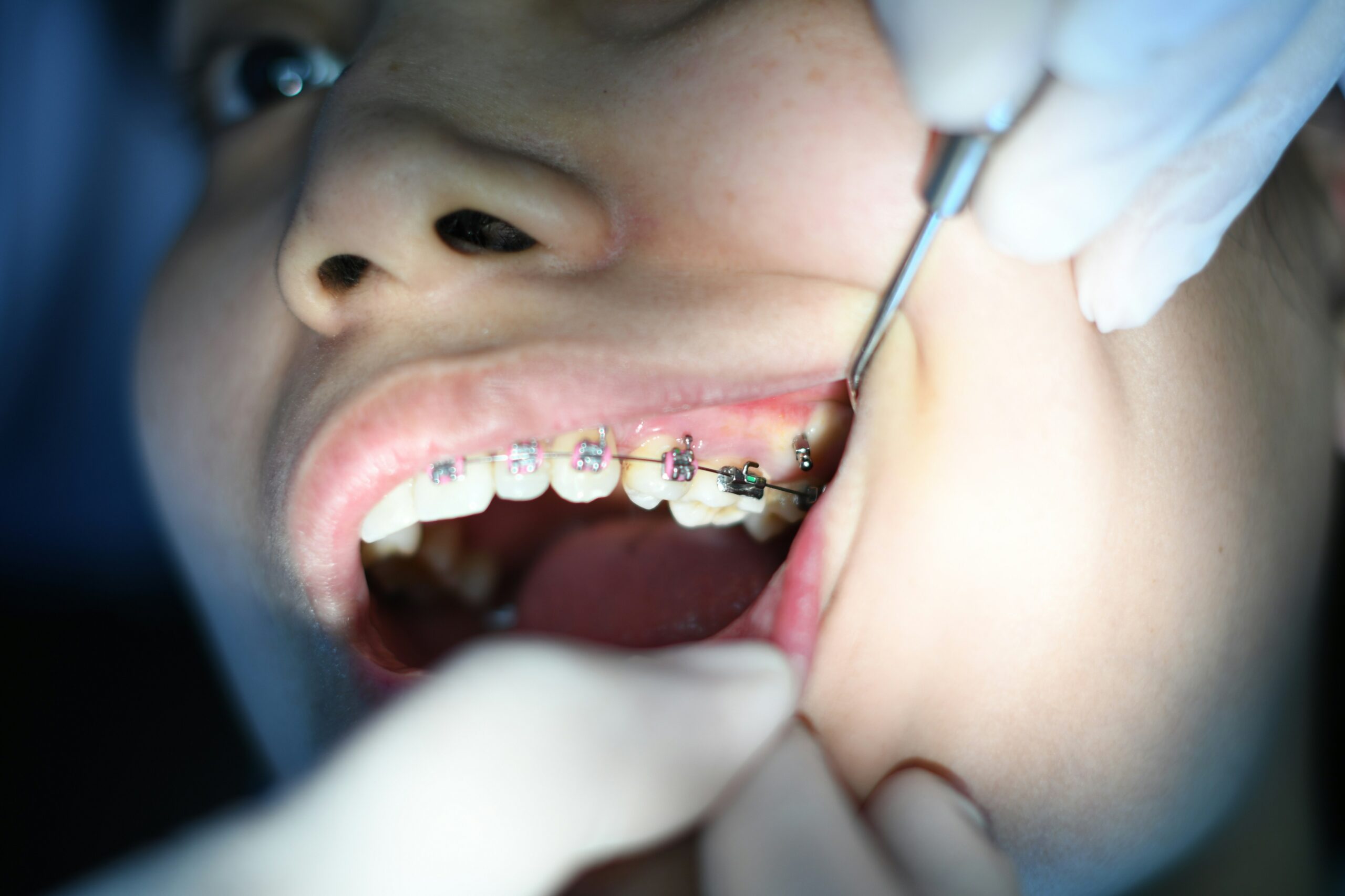 What is orthodontic treatment
