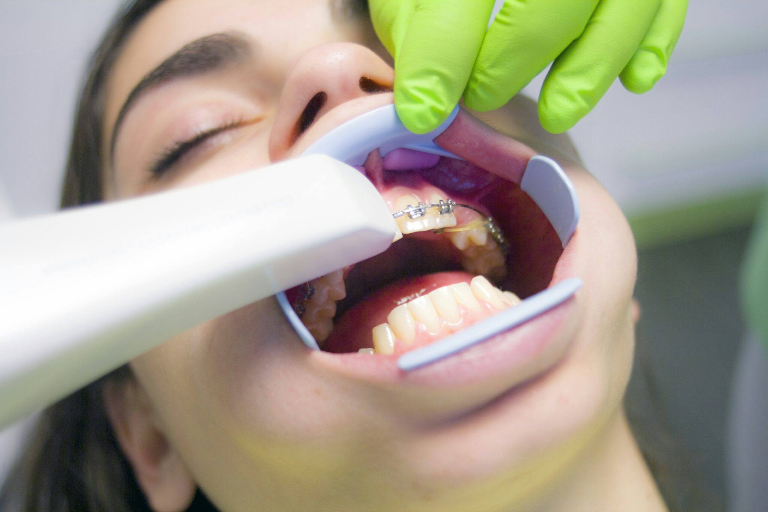 Why orthodontic treatment is necessary