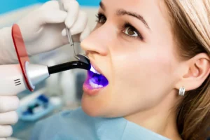 The Top 8 Disadvantages of Teeth Bonding