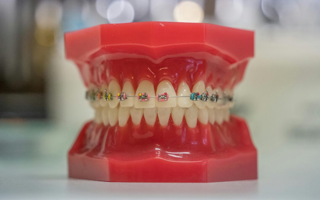 What are Cosmetic Dental Procedures?