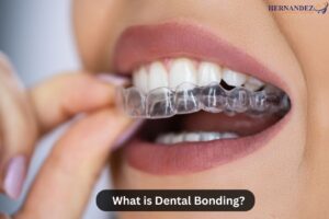 What is Dental Bonding?