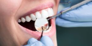 General Dentist vs Cosmetic Dentist