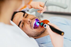 Cosmetic Bonding