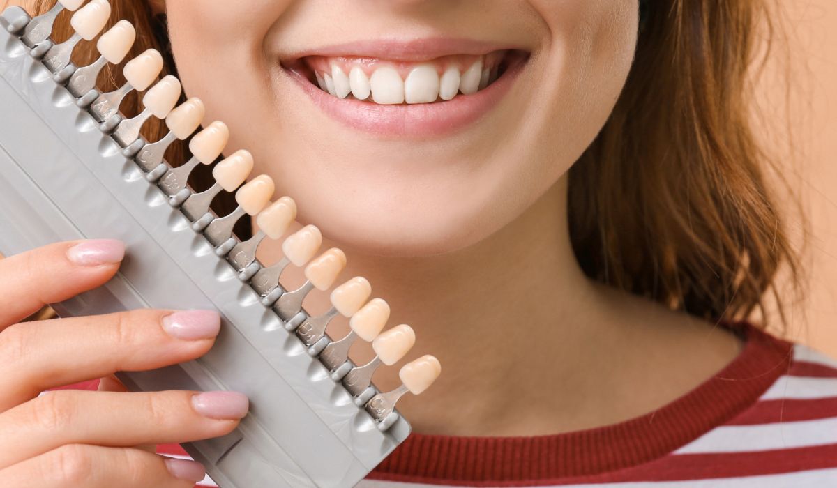 7 Tips for Caring for Your Veneers in San Antonio