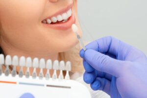Caring for Veneers