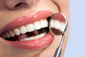 Full Mouth Reconstruction in San Antonio TX