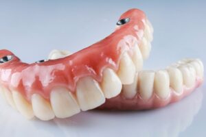 What is dental composite bonding?​