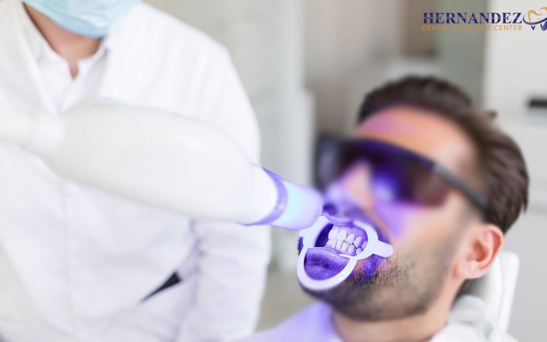 Best Teeth Bonding Clinic Near San Antonio, TX for a Perfect Smile
