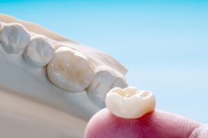 How Long Do Dental Crowns Last