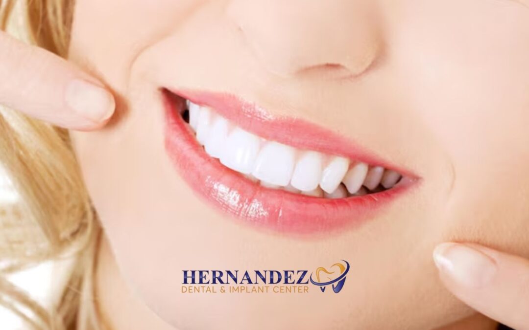 What Is Teeth Bleaching? Everything You Need to Know