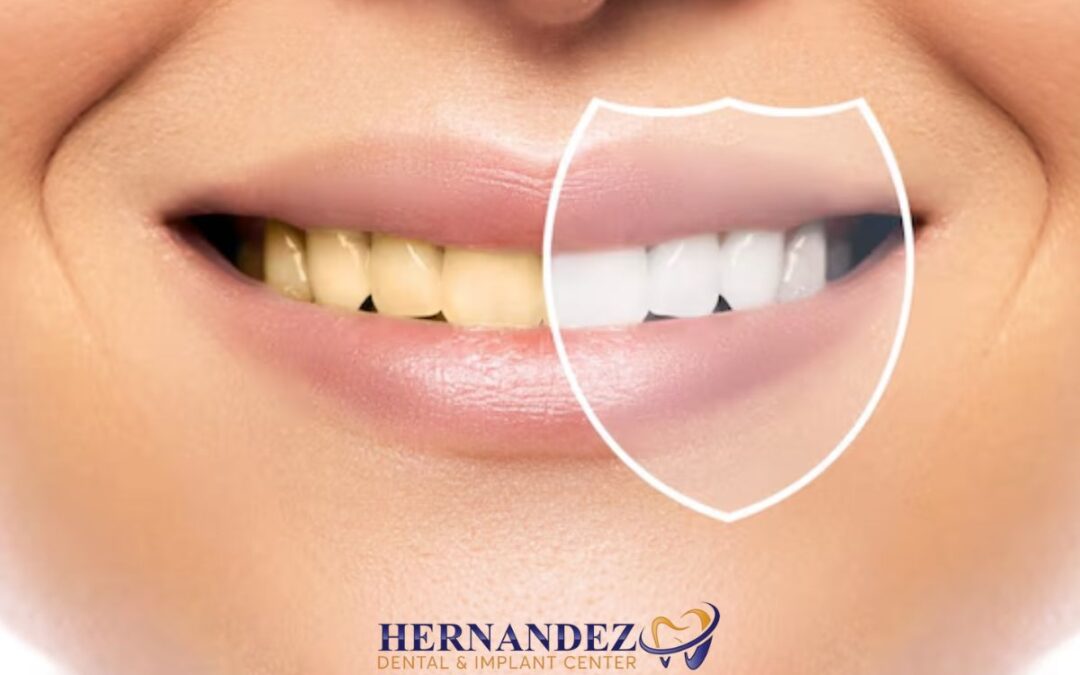 Why Do I Have Yellow Teeth? A Simple Guide