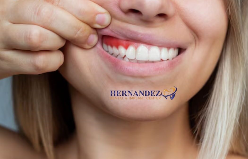 Receding Gums: Causes and Treatment Guide